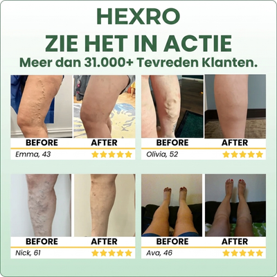 Hexro™ Miracle Balm
